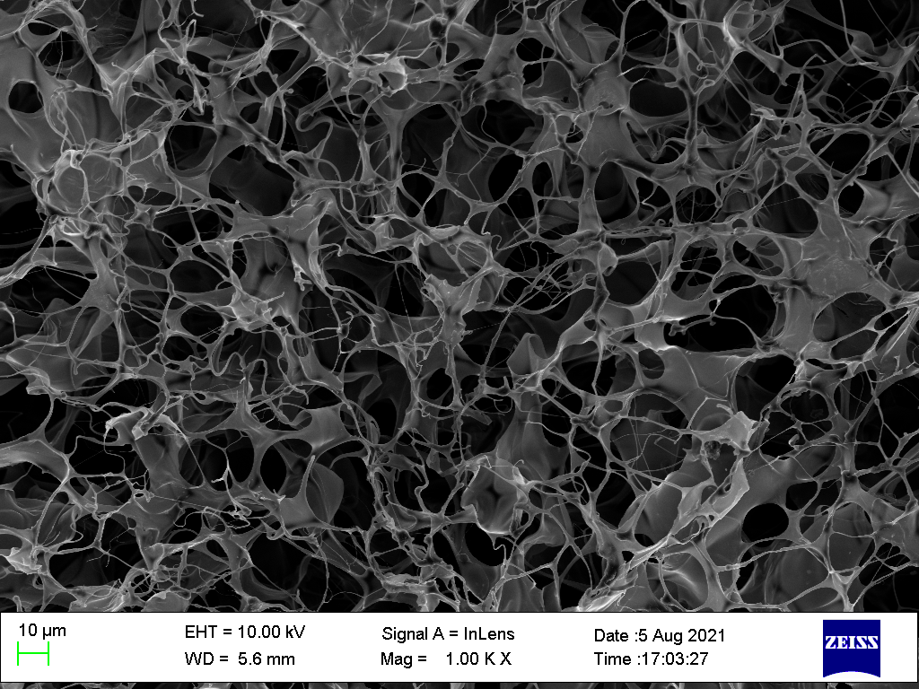 Up: Scanning electron microscopy (SEM) image showing the interconnected porous microstructure of the hydrogel scaffold.